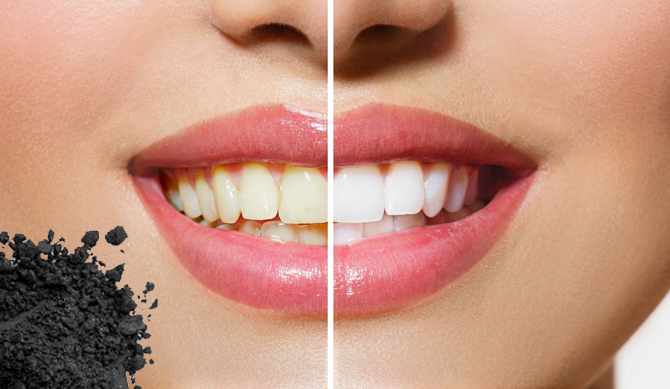 do charcoal whiten teeth